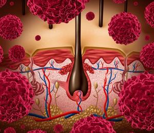 The FDA indicated that data from the phase 1/2 IGNYTE trial were not adequate to provide evidence of effectiveness.