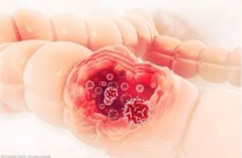 The test may help identify patients with microsatellite instability-high colorectal cancer who benefit from nivolumab therapy alone or with ipilimumab.