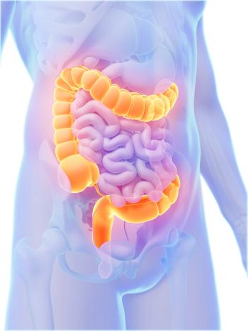 colorectal cancer