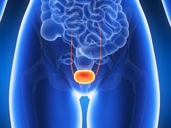 Patients with low-grade upper tract urothelial carcinoma achieved a long period of durable response after undergoing treatment with UGN-101.