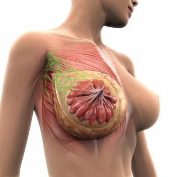 A patient reported outcome analysis of the phase 3 OlympiA trial found that treatment-emergent symptoms were easily resolved after treatment with olaparib for BRCA1/2 high-risk HER2-negative breast cancer ended. 