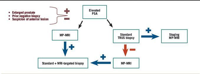When To Order An Mri In The Initial Evaluation And Management Of Prostate Cancer When To Order An Mri In The Initial Evaluation And Management Of Prostate Cancer