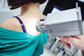 melanoma, skin cancer, active surveillance