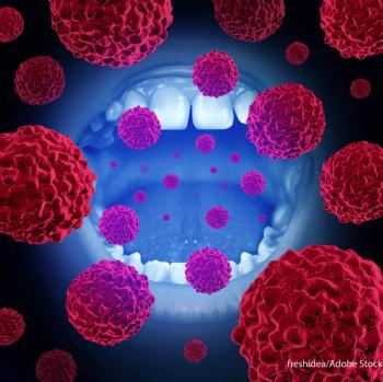 Prognostic Factors Linked With Poor Locoregional Control in Tongue Cancer | Image Credit: © freshidea - stock.adobe.com.