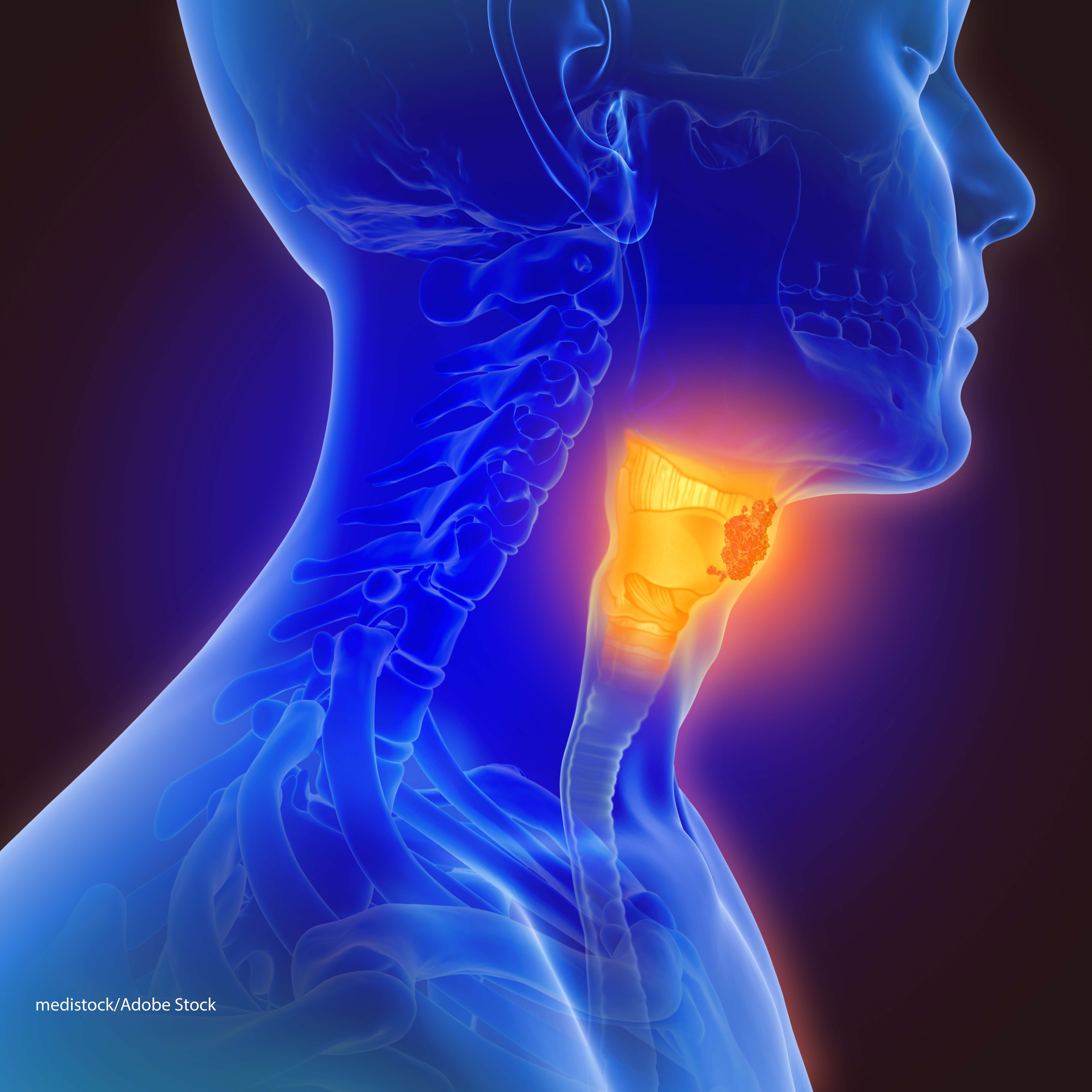 Hpv for throat