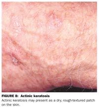 A color atlas of skin lesions