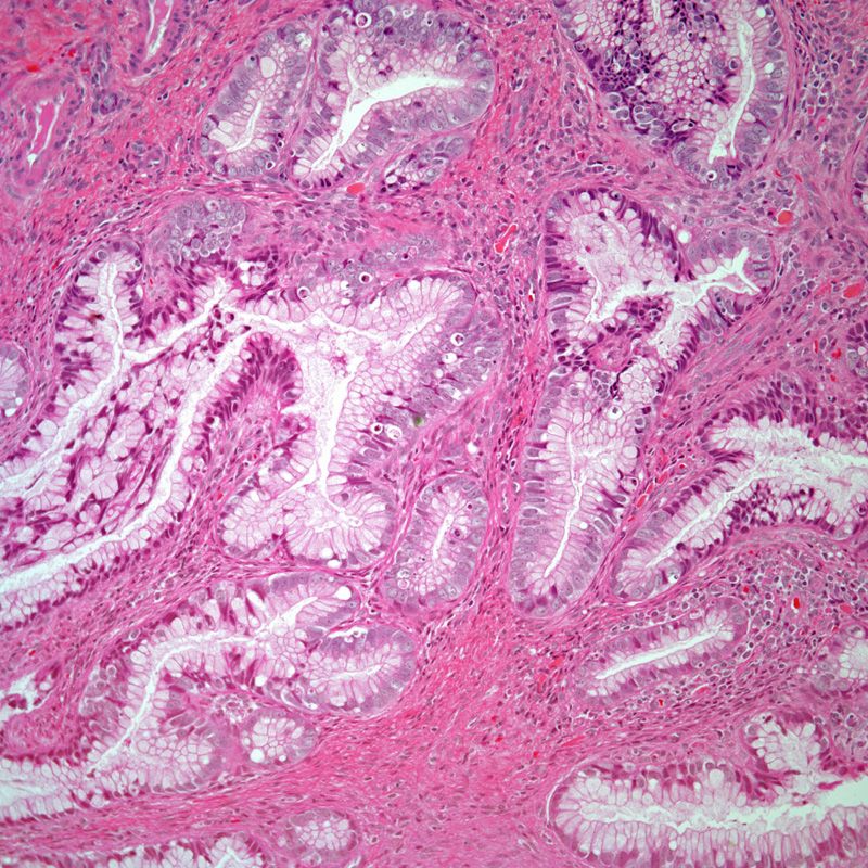 Urgent 26 Year Old Womans Severe Vaginal Bleeding - 19ikyg4