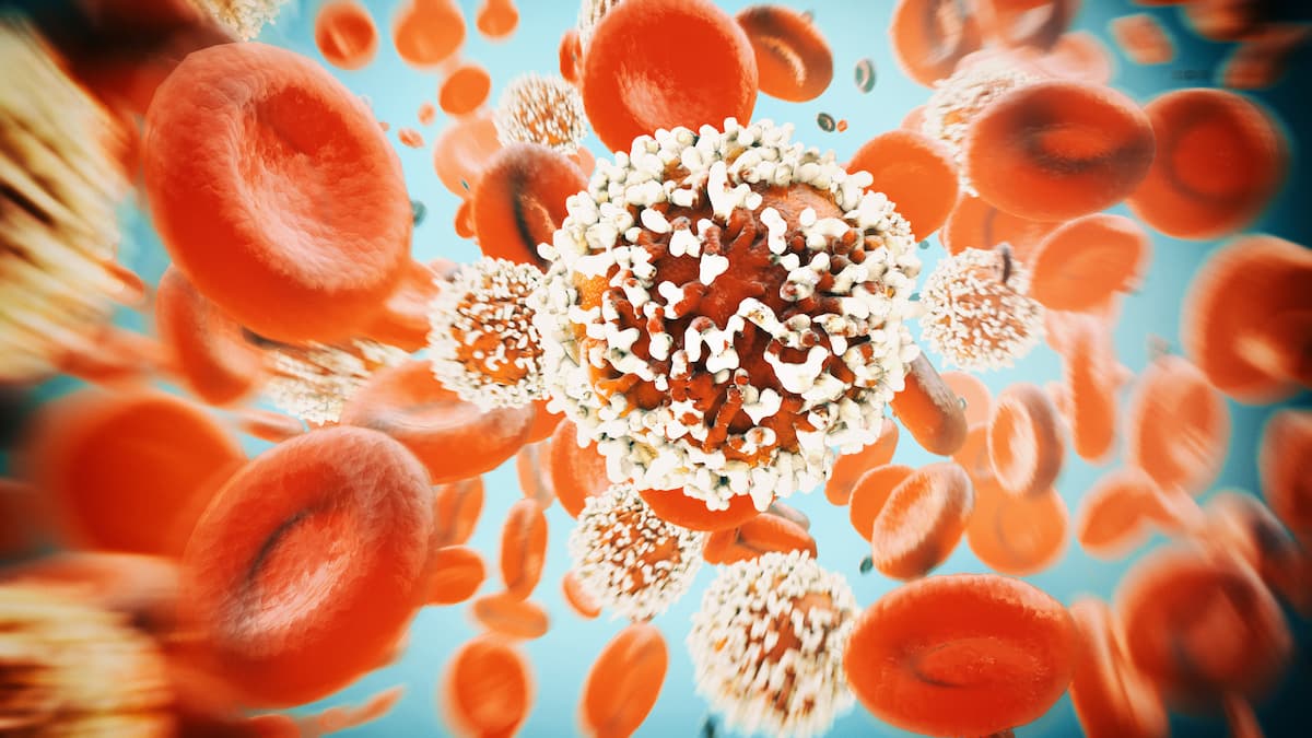 Novel CD19 CAR-NK Therapy Yields Responses in Waldenstrom Macroglobulinemia