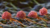 Small Cell Lung Cancer Cells: These rapidly dividing, small, round cells in the lungs are known for their early metastasis, leading to aggressive cancer. | Image Credit: © Best - stock.adobe.com 