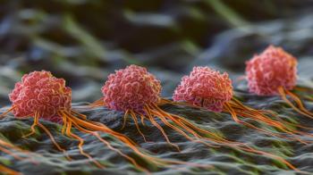 Small Cell Lung Cancer Cells: These rapidly dividing, small, round cells in the lungs are known for their early metastasis, leading to aggressive cancer. | Image Credit: © Best - stock.adobe.com
