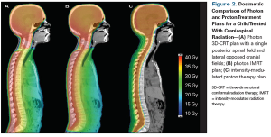 Optimizing the Benefit of CNS Radiation Therapy in the Pediatric Population-PART 2: Novel Methods of Radiation Delivery