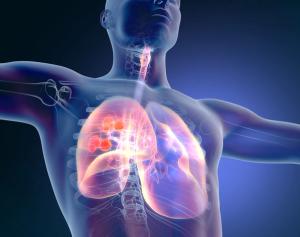A proactive regimen reduces dermatologic AEs in patients with NSCLC who were treated with amivantamab and lazertinib, enhancing treatment adherence.