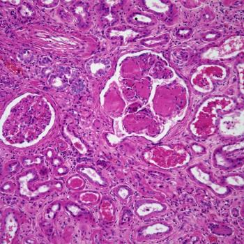 Findings from the phase 1/2 MajesTEC-1 trial suggest that preemptively planning and promptly managing cytokine release syndrome with supportive care in patients with multiple myeloma treated with T-cell–engaging bispecific antibodies may be beneficial.