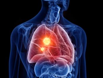 Nursing Strategies for the 3 First-Line Regimens in EGFR-Mutated NSCLC: © Sebastian Kaulitzki - stock.adobe.com