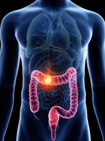 FDA Clears Triton Robotic Endoscopy System for Colon Procedures: © Sebastian Kaulitzki - stock.adobe.com
