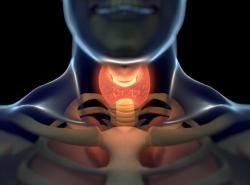 Eric J. Sherman, MD, Examines Trametinib Plus Paclitaxel in Anaplastic Thyroid Cancer