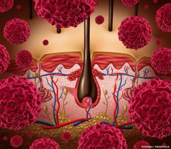 Investigators of the phase 3 C-POST trial will continue to follow up with patients and assess the key secondary end point of overall survival.