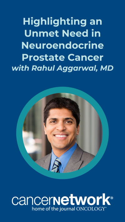 Despite accounting for less than 1% of prostate cancer diagnoses, neuroendocrine prostate cancer (NEPC) is associated with suboptimal outcomes in the space, according to Rahul Aggarwal, MD.