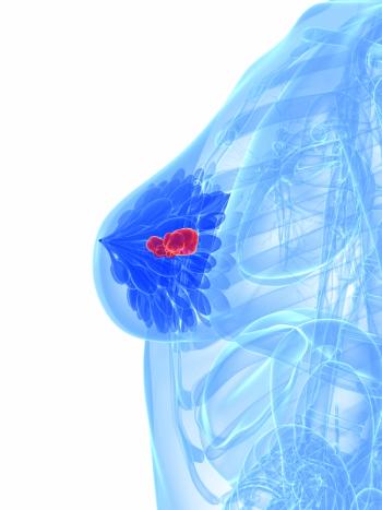 Although the ORR was similar among patients treated with sacituzumab govitecan vs chemotherapy for TNBC, the DOR was higher with the sacituzumab govitecan.