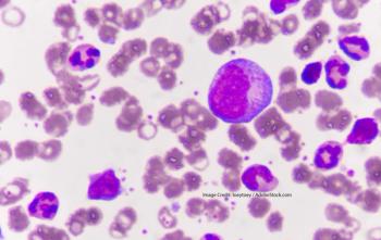 Acute Myeloid Leukemia and EVI1 (MECOM)
