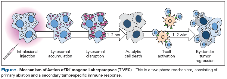 Tvec Injection Technique The Role of Intralesional Therapies in Melanoma
