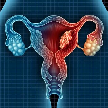 A significant survival improvement was observed among patients with dMMR carcinomas who received atezolizumab/chemotherapy.