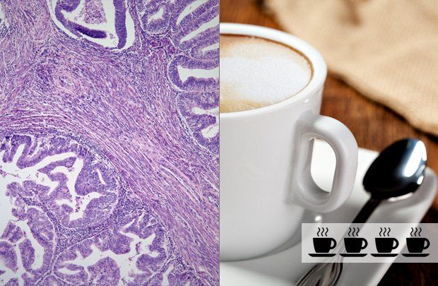 Coffee and endometrial cancer risk