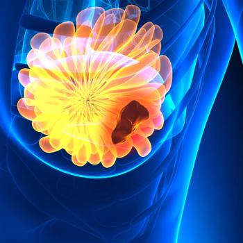 Zotaifin plus abemaciclib and fulvestrant appears to produce no dose-limiting toxicities among patients with estrogen receptor–positive metastatic breast cancer in a phase 1/2 study.