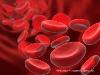 The addition of comprehensive bridging radiotherapy to extramedullary disease sites before CAR T therapy may improve PFS outcomes in multiple myeloma.