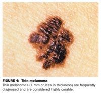 A color atlas of skin lesions