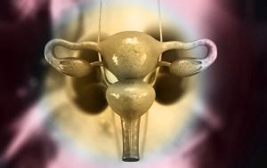 While the trial enrolled patients with renal cell carcinoma and ovarian cancer, the component of the trial including those with renal cell carcinoma was discontinued. 
