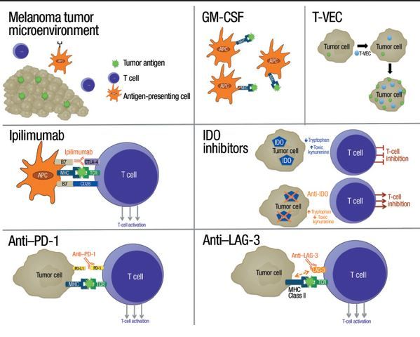 Combined Nivolumab and Ipilimumab in Melanoma Metastatic to the