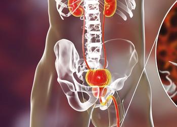 Enzalutamide plus leuprolide appears to improve metastases-free survival vs placebo plus leuprolide in patients with non-metastatic hormone-sensitive prostate cancer.