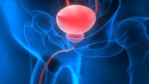No dose-limiting toxicities or unexpected adverse effects occurred with carotuximab/apalutamide in metastatic castration-resistant prostate cancer.