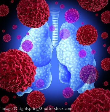 Illustration of a human lung