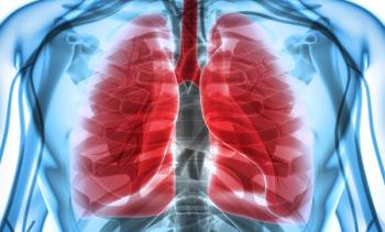 Notable PFS Benefit, Significant Intracranial Response Observed With Brigatinib Vs Crizotinib in ALK+ NSCLC