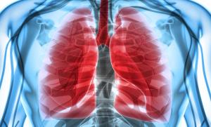 Investigators Look Past Standard Immunotherapy for Additional Lung Cancer Solutions