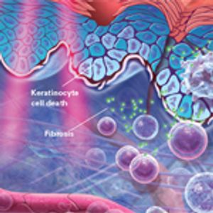 Radiation Dermatitis: Recognition, Prevention, and Management