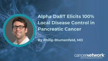 Philip Blumenfeld, MD, reviewed efficacy signals from a pooled analysis of Alpha DaRT in pancreatic cancer.