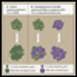 Richter's Transformation in Chronic Lymphocytic Leukemia