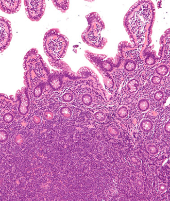 Objective response rate appears to be numerically higher for patients receiving zanubrutinib for relapsed/refractory mantle cell lymphoma in the second-line setting than in later lines of treatment. 
