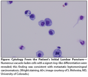 Subacute Headache in a Patient With Metastatic Gastric Cancer