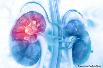 Lenvatinib Combo Demonstrates Use in Frontline Advanced Non–Clear Cell RCC | Image Credit: © Crystal light - stock.adobe.com.