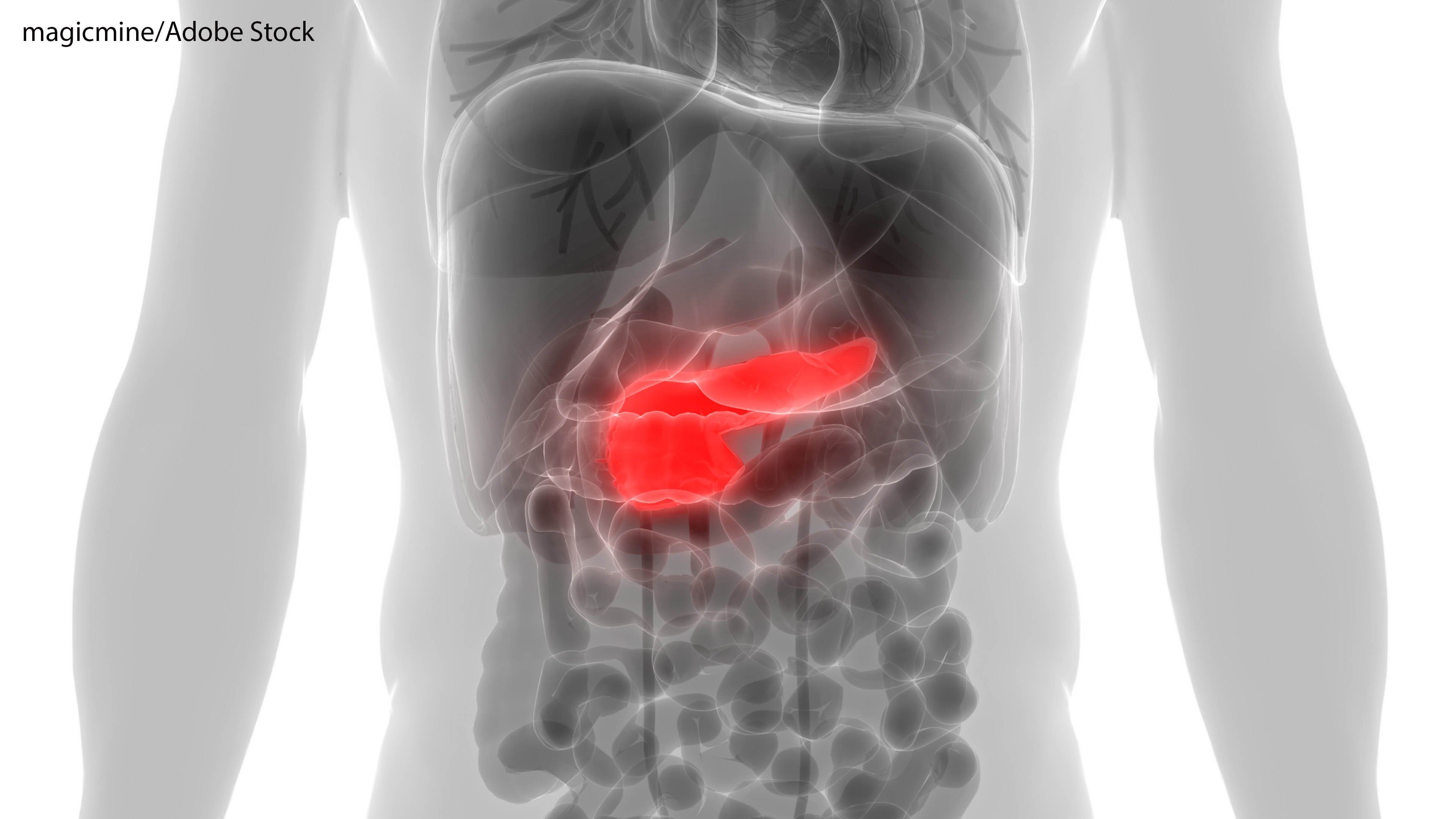The decision follows safety data from the phase 1/2 LOKON001 trial evaluating LOAd703 in advanced pancreatic ductal adenocarcinoma.