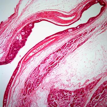 Investigators expect to have a readout of topline data from the phase 2 OPTIMIZE-1 trial evaluating mitazalimab plus chemotherapy in metastatic pancreatic ductal adenocarcinoma in early 2024. 