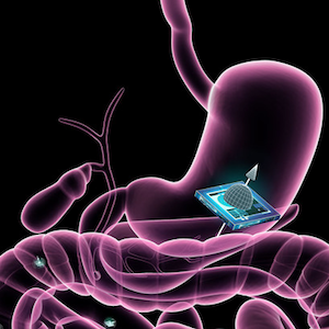 How New MRI-Inspired "Smart Pills" Could Optimize Diagnostic Testing