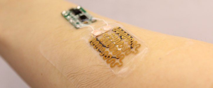 smart bandage,wound monitoring,wound microprocessor,hca news