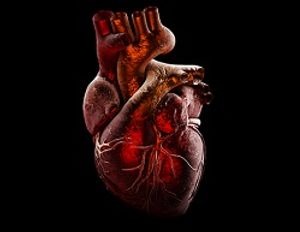 Pacemakers Can Be Hacked, Manufacturer Confirms