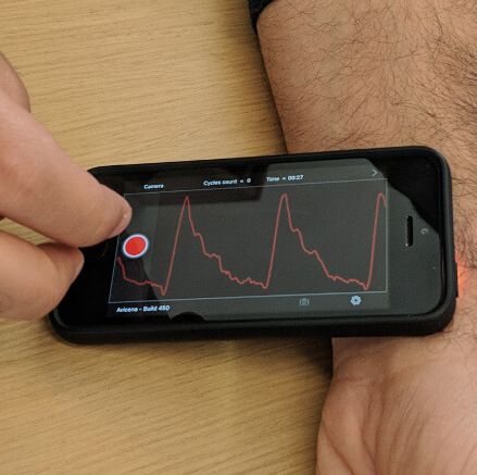 Paired With A Good Algorithm, A Smartphone Camera Might Detect Heart ...