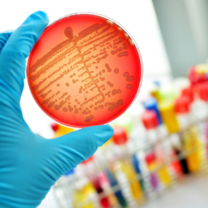 Alert System Reduces Hospital Stays, Mortality in Patients with Sepsis